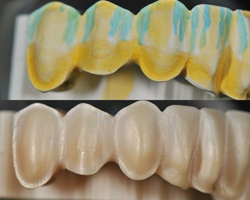 Zirconia+col-2880w